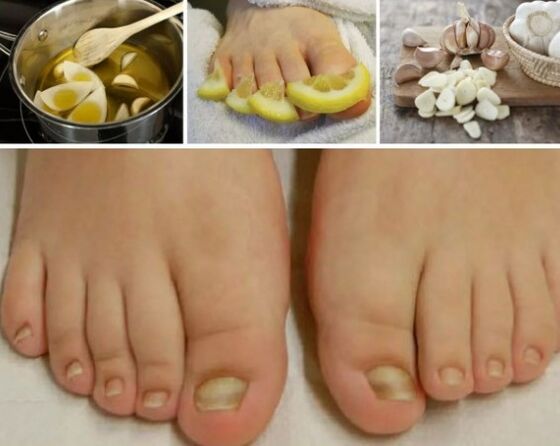 People's funds against nail fungus