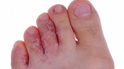 Types and phases of the development of mushrooms on the legs