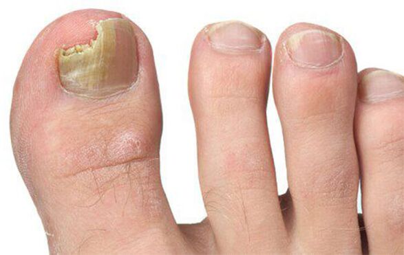 Different forms of mushrooms