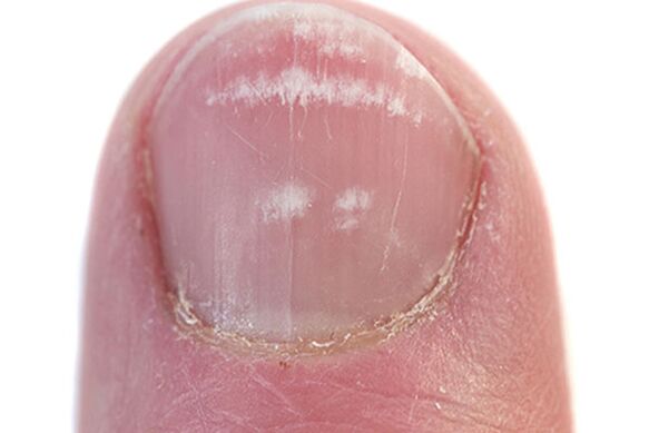 The first signs and symptoms