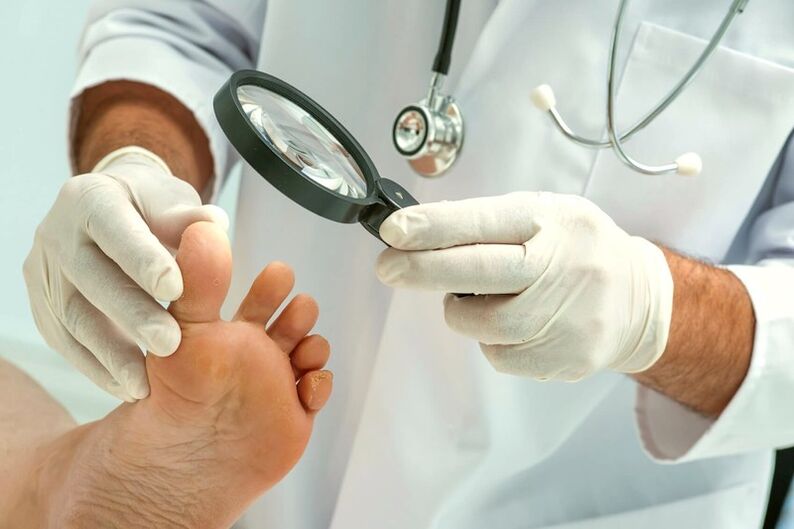 Dermatologist examines toenails