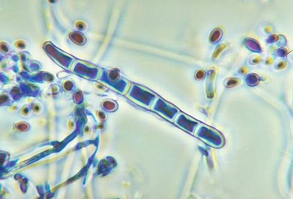 Mushroom Trichophyton rubrum under the microscope