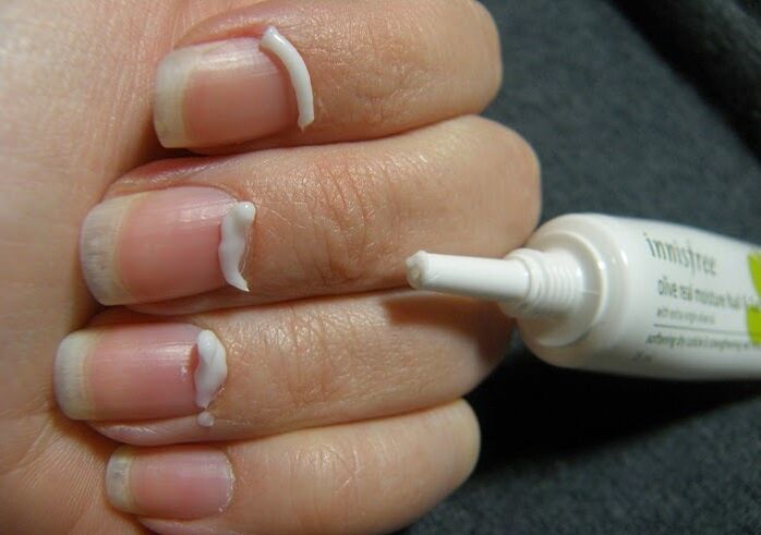 Treatment of nail fungus with ointment